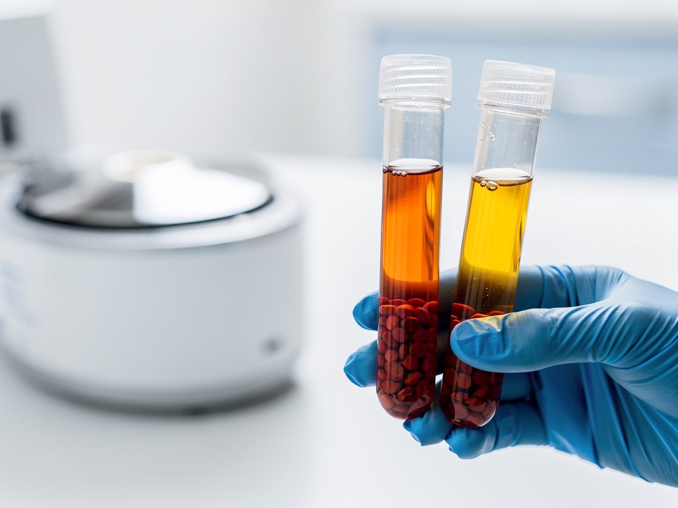 Probenröhrchen mit goldenem Plasma über rotem Blut neben einer Zentrifuge