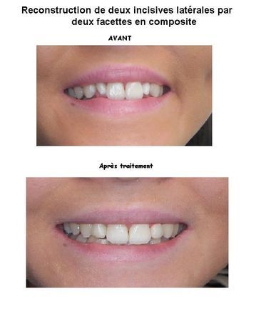 Docteur Gärdby Eva - reconstitution dentaire