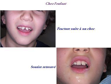 Docteur Gärdby Eva - reconstitution dentaire