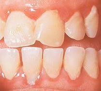 Docteur Gärdby Eva -blanchiment des dents