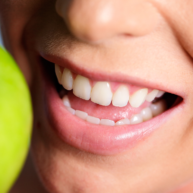 Nahaufnahme der Zähne einer Frau , die einen grünen Apfel isst