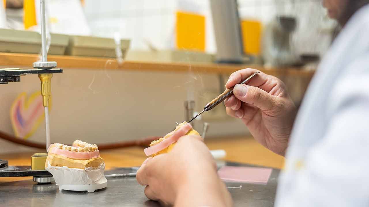 Ein Zahnarzt bearbeitet mit einem Lötkolben eine Zahnprothese.