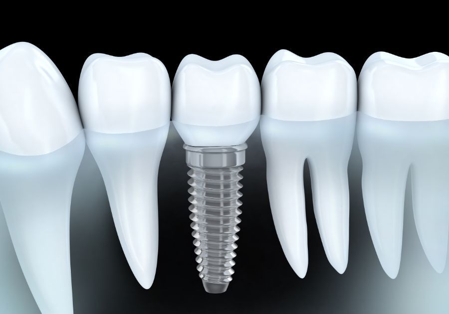 Las piezas dentales