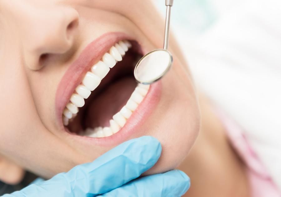 Los nuevos implantes dentales sin cirugía