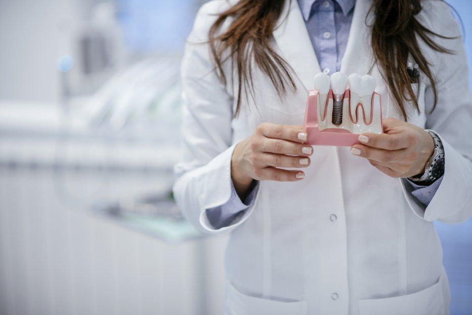 Cómo cuidar tus implantes dentales para una vida larga y saludable