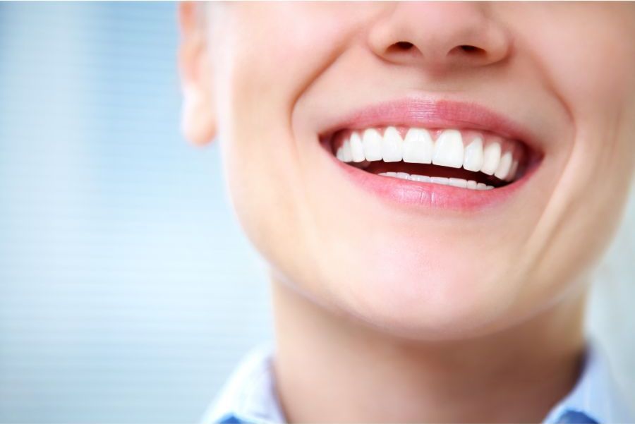 Una sonrisa perfecta con carillas dentales