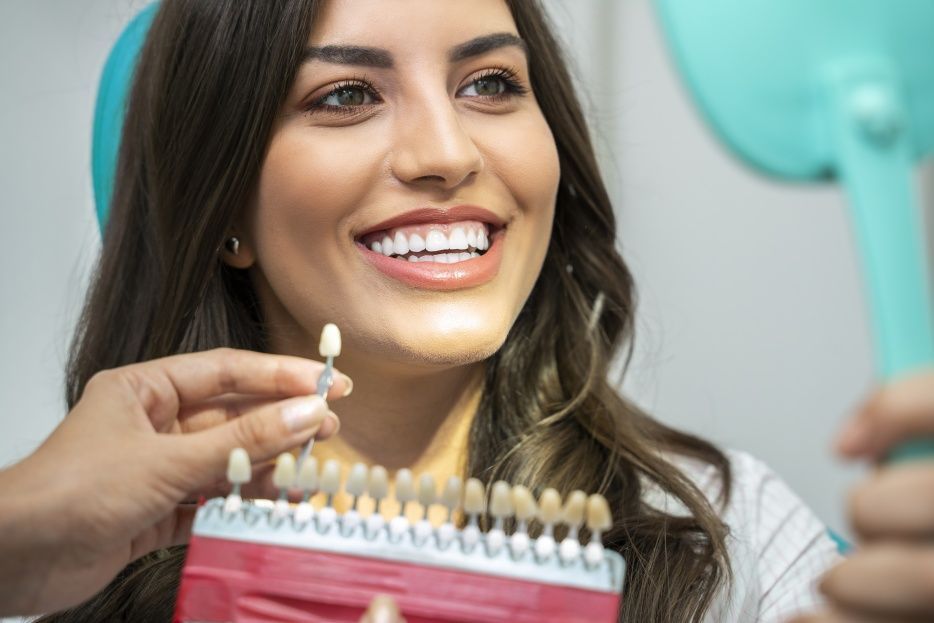 Cómo elegir la carilla dental ideal según tu sonrisa
