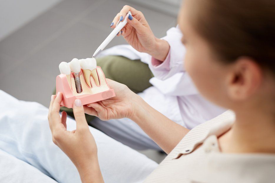 ¿Cómo se lleva a cabo la colocación de un implante dental?