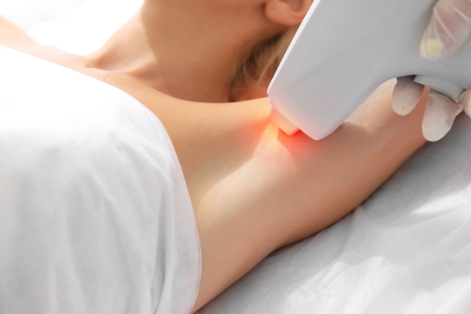 Depilación láser