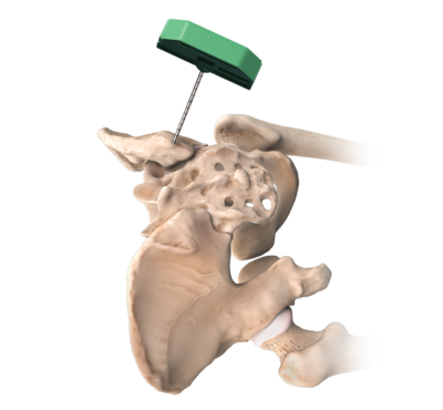 Arthrex- Cabinet médical Dr Maxime Pilloud