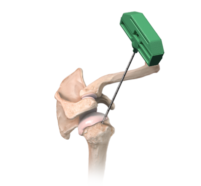 Arthrex- Cabinet médical Dr Maxime Pilloud