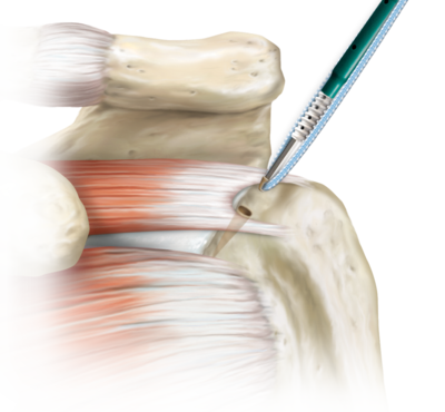 Arthrex- Cabinet médical Dr Maxime Pilloud