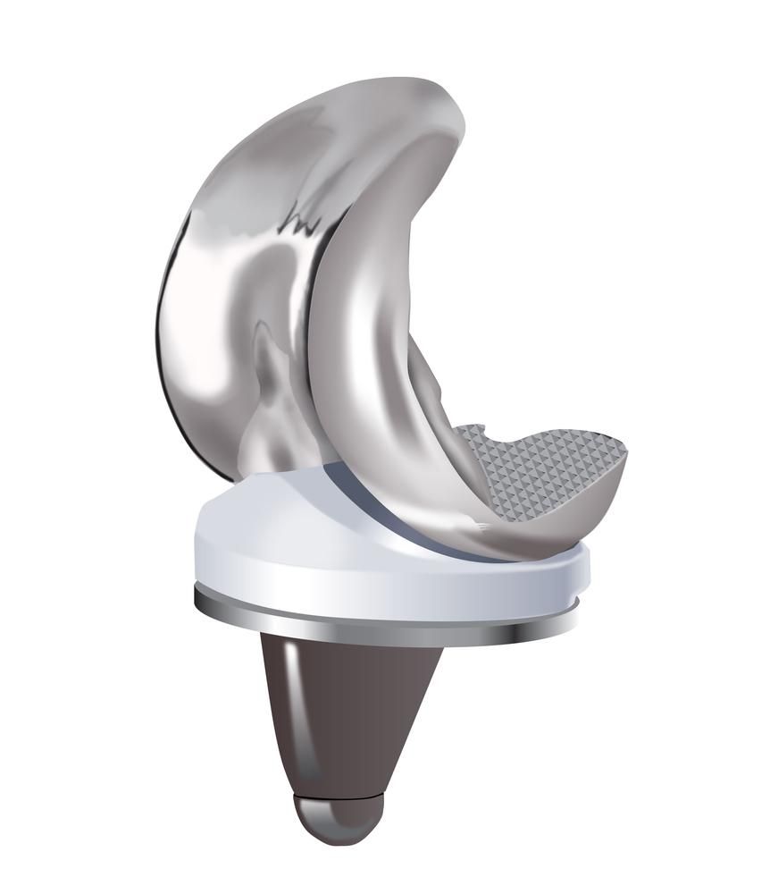 prothèses - Cabinet médical Dr Maxime Pilloud