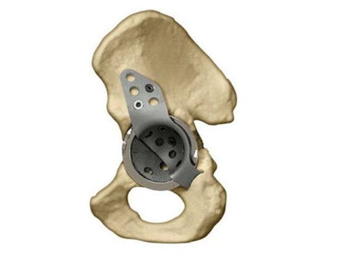 prothèses - Cabinet médical Dr Maxime Pilloud