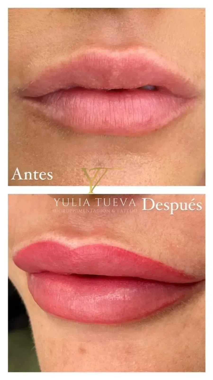 Labios antes y después del tratamiento, mostrando resultados más voluminosos y rosados en la imagen inferior.