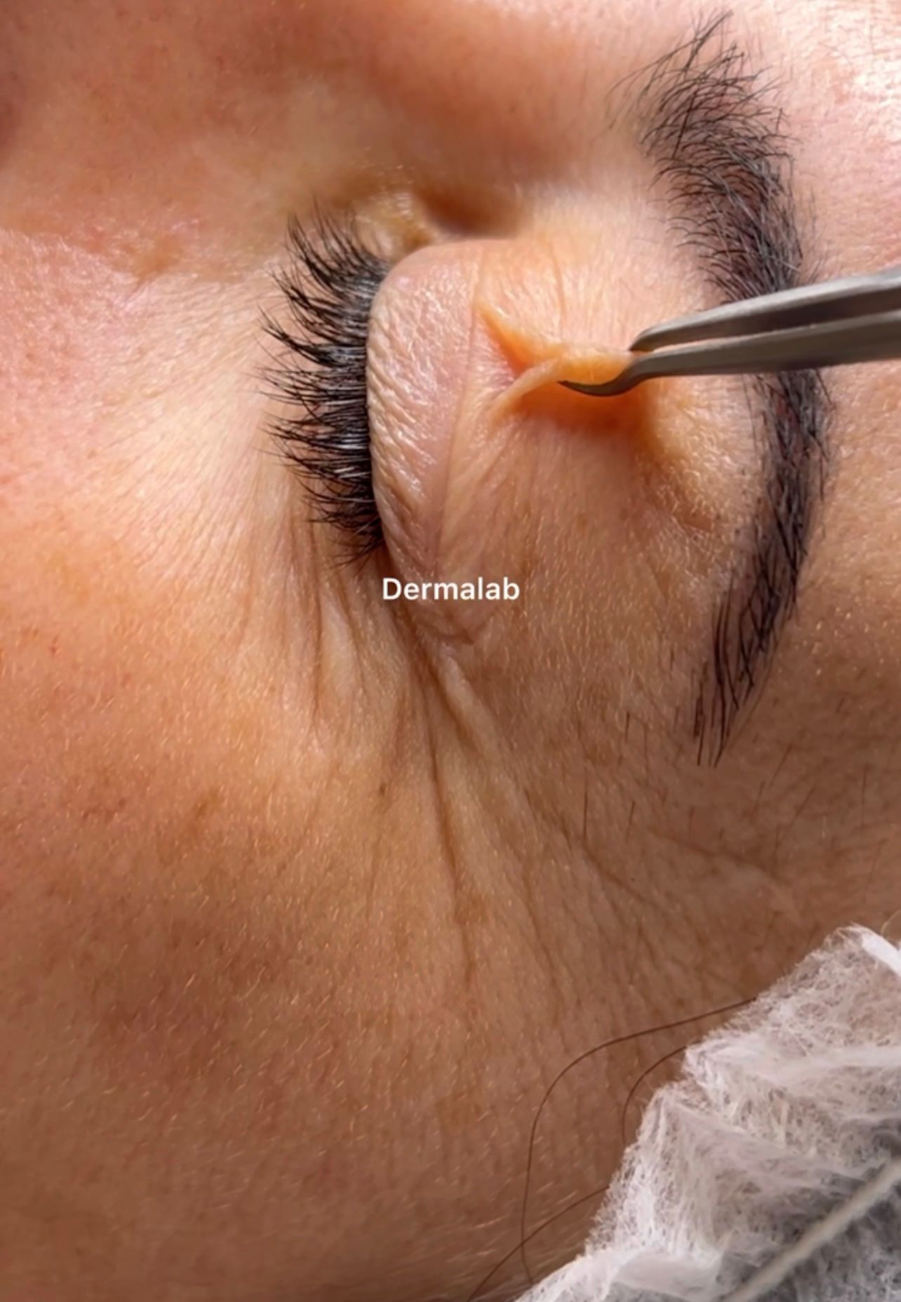 Un primer plano de la cara de una mujer con pinzas.