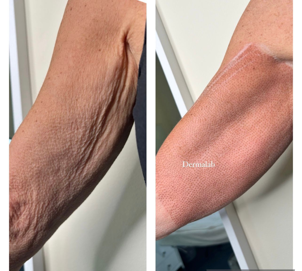 Una foto de antes y después del brazo de una mujer.