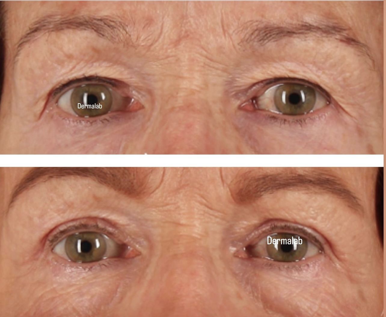 Una foto de antes y después de los ojos de una mujer.