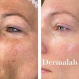 Una fotografía de antes y después del rostro de una mujer.