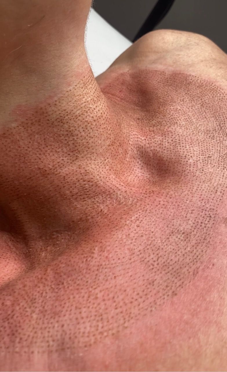 Un primer plano del cuello y el pecho de una persona.