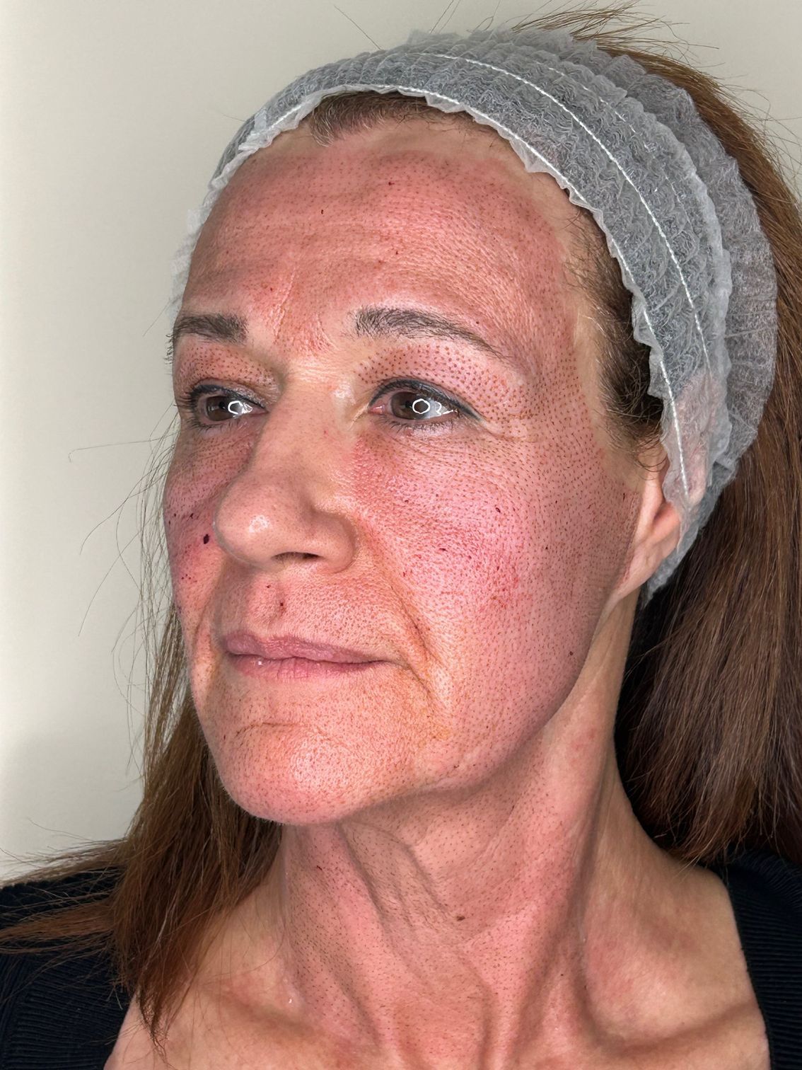 Una mujer con una diadema en la cabeza mira a la cámara.