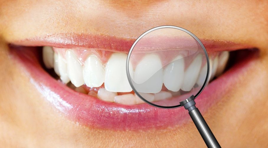 Dentalhygiene | Zahntechnik | Zahnprothetik Vasi-Dental | Zürich