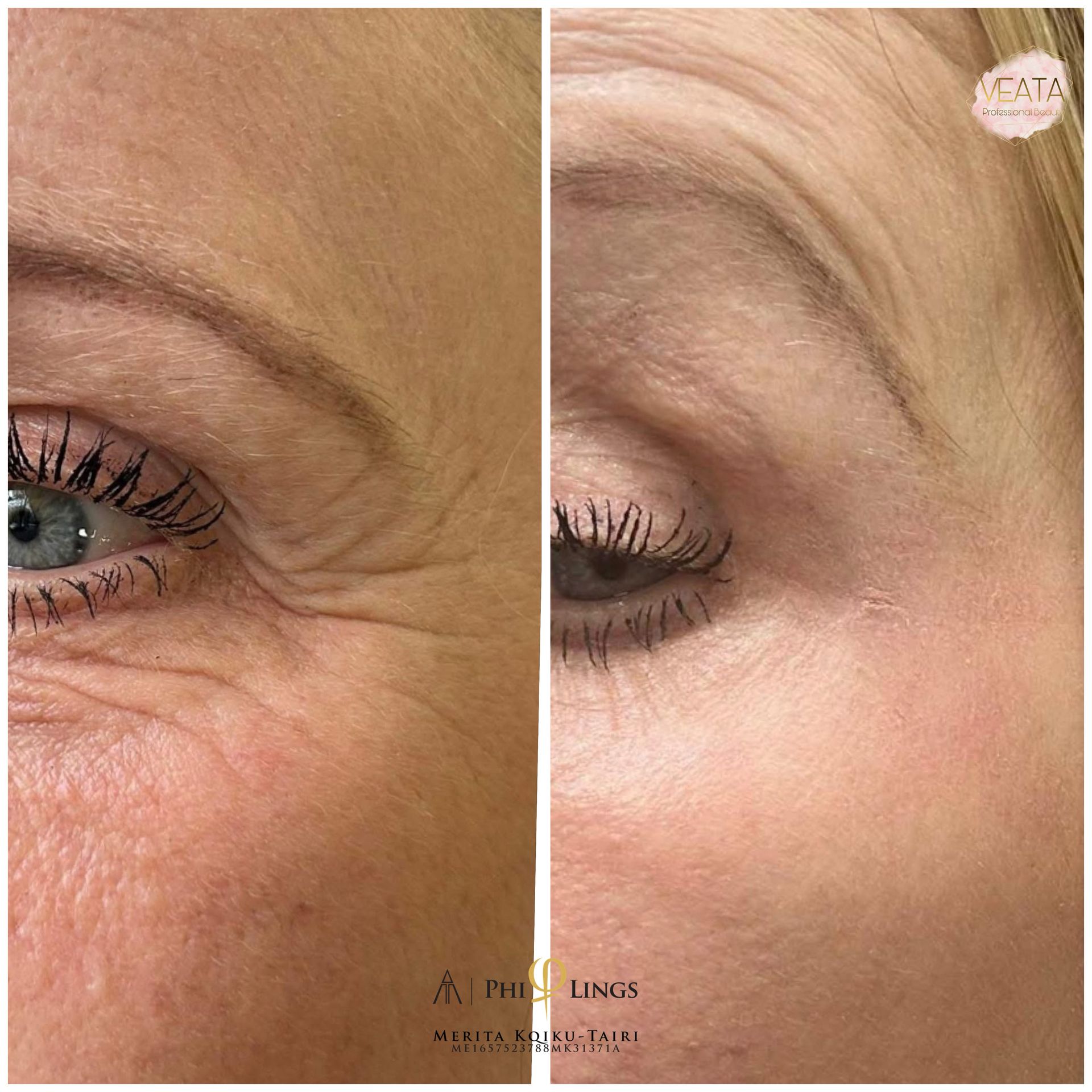 Frau erhält in einem Spa eine Gesichtsbehandlung mit einem Handgerät.