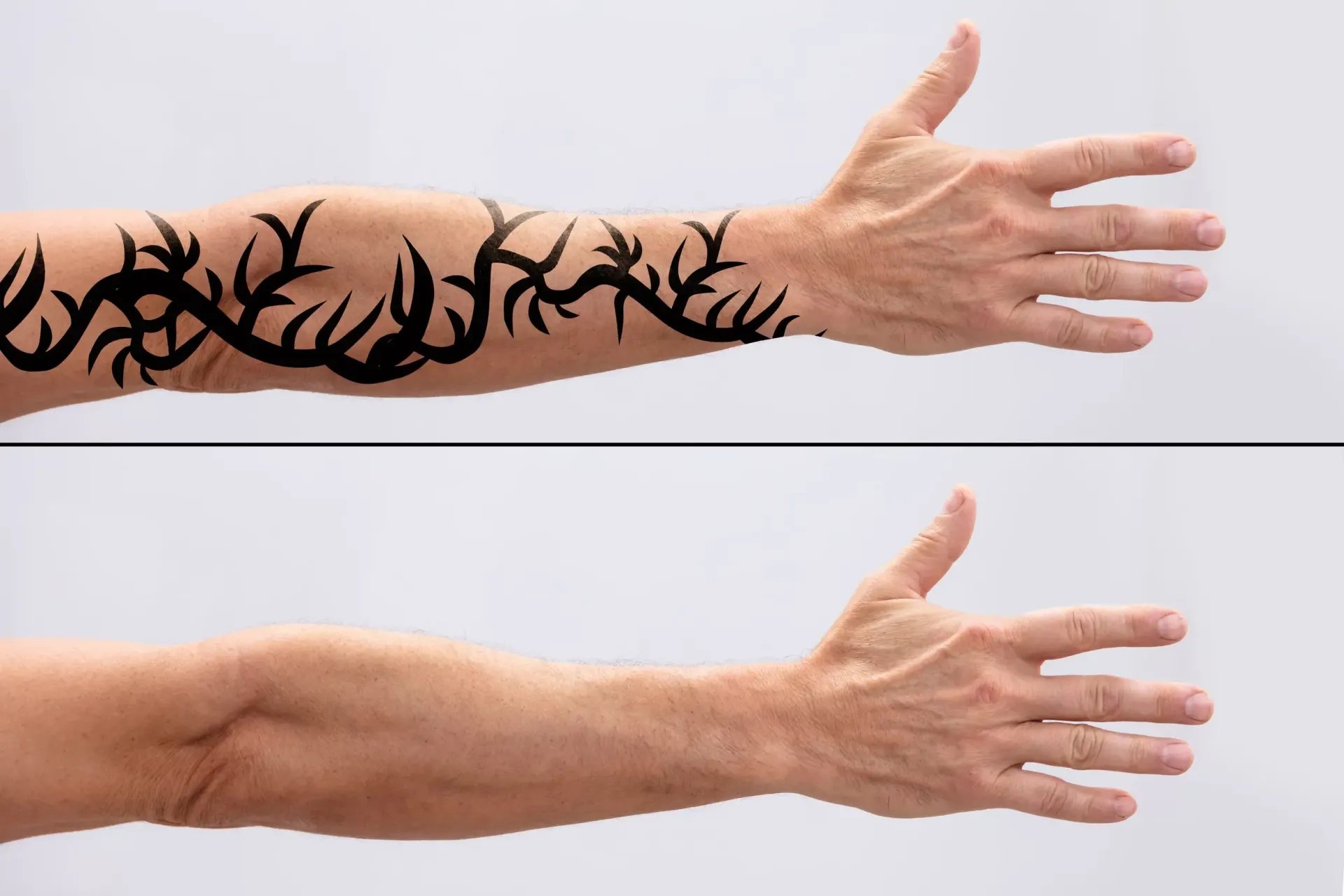 Una comparación que muestra un brazo con un tatuaje de una enredadera negra encima del mismo brazo sin el tatuaje.