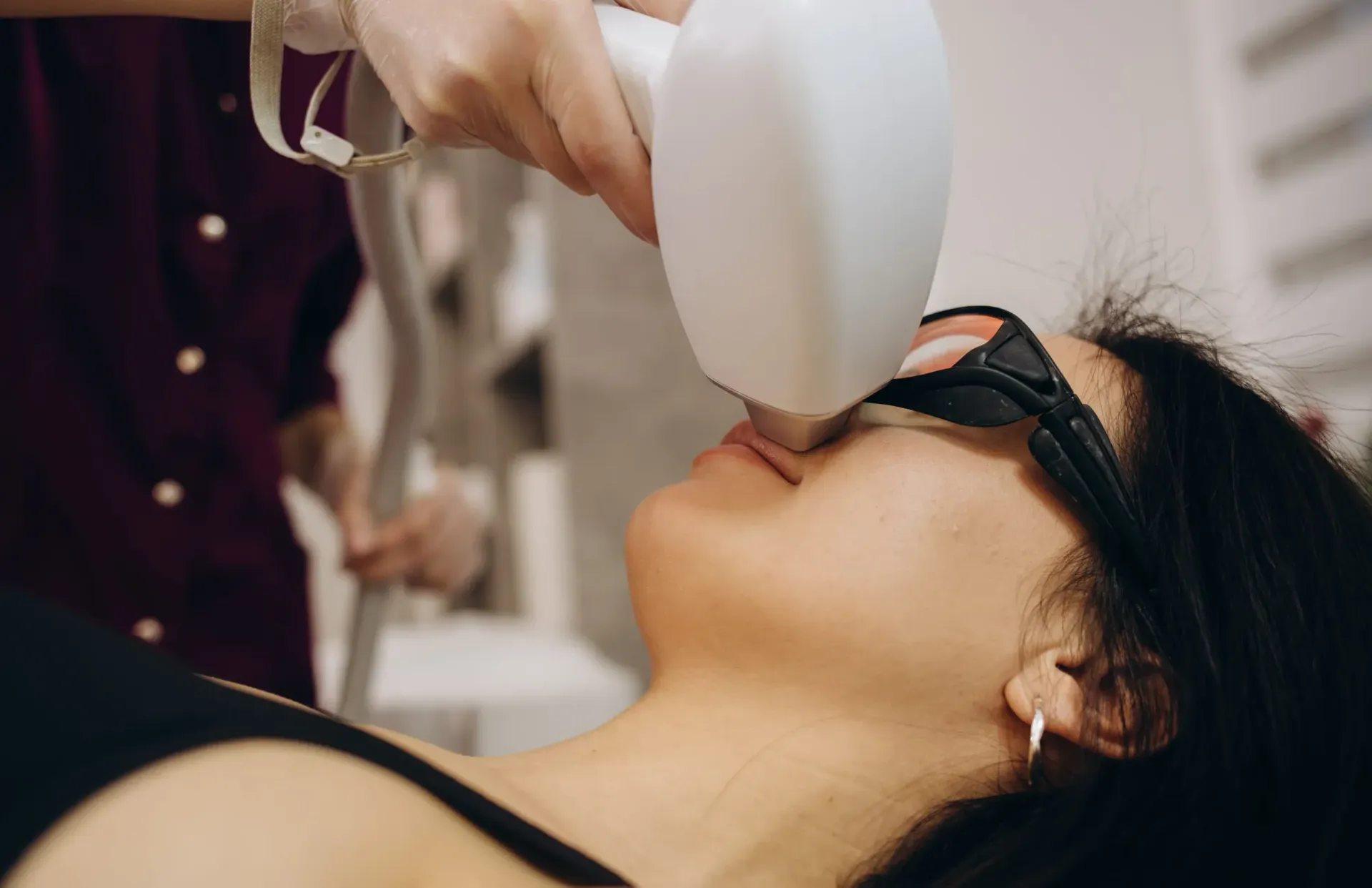 En una clínica, un profesional utiliza un dispositivo de depilación láser en la zona del labio superior de una clienta.