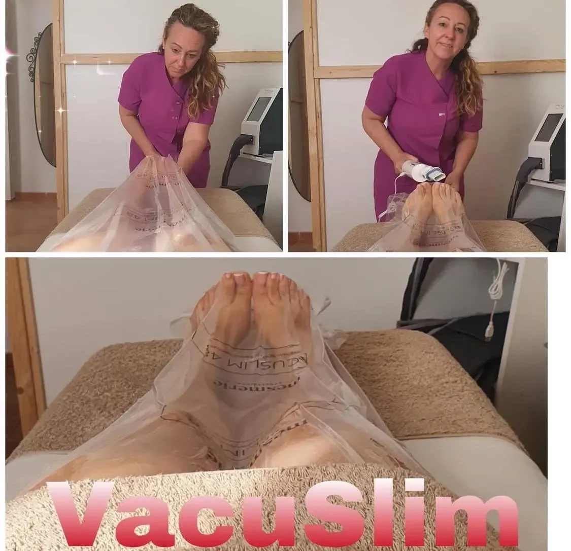 Un técnico realiza un tratamiento corporal VacuSlim