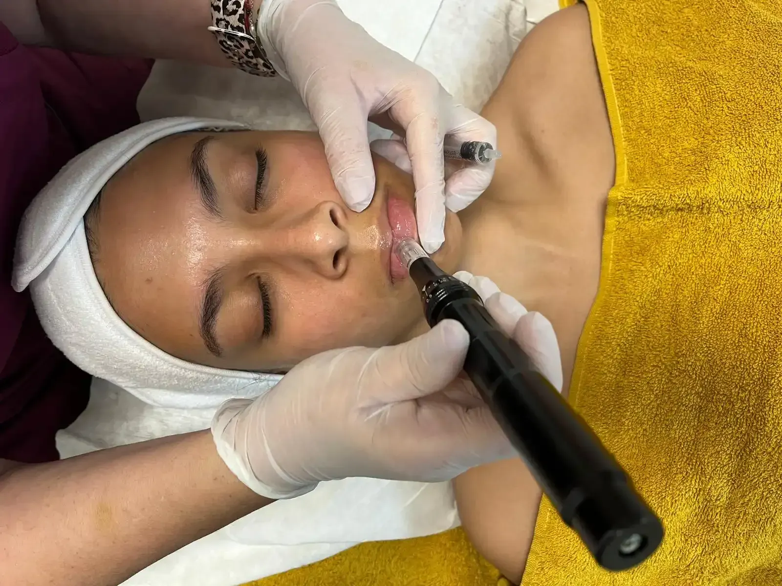 Durante un tratamiento cosmético, un profesional con guantes