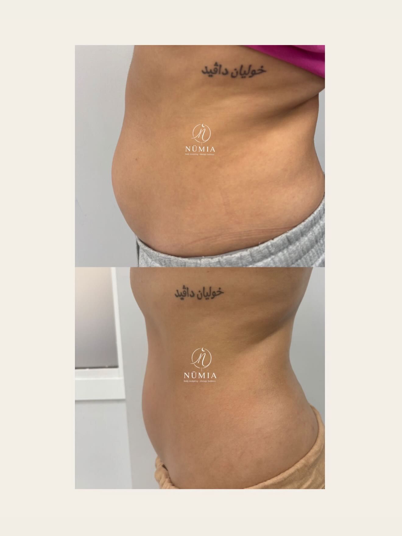 Primer plano de un torso desnudo con el ombligo visible, vistiendo pantalones cortos oscuros sobre una cama.