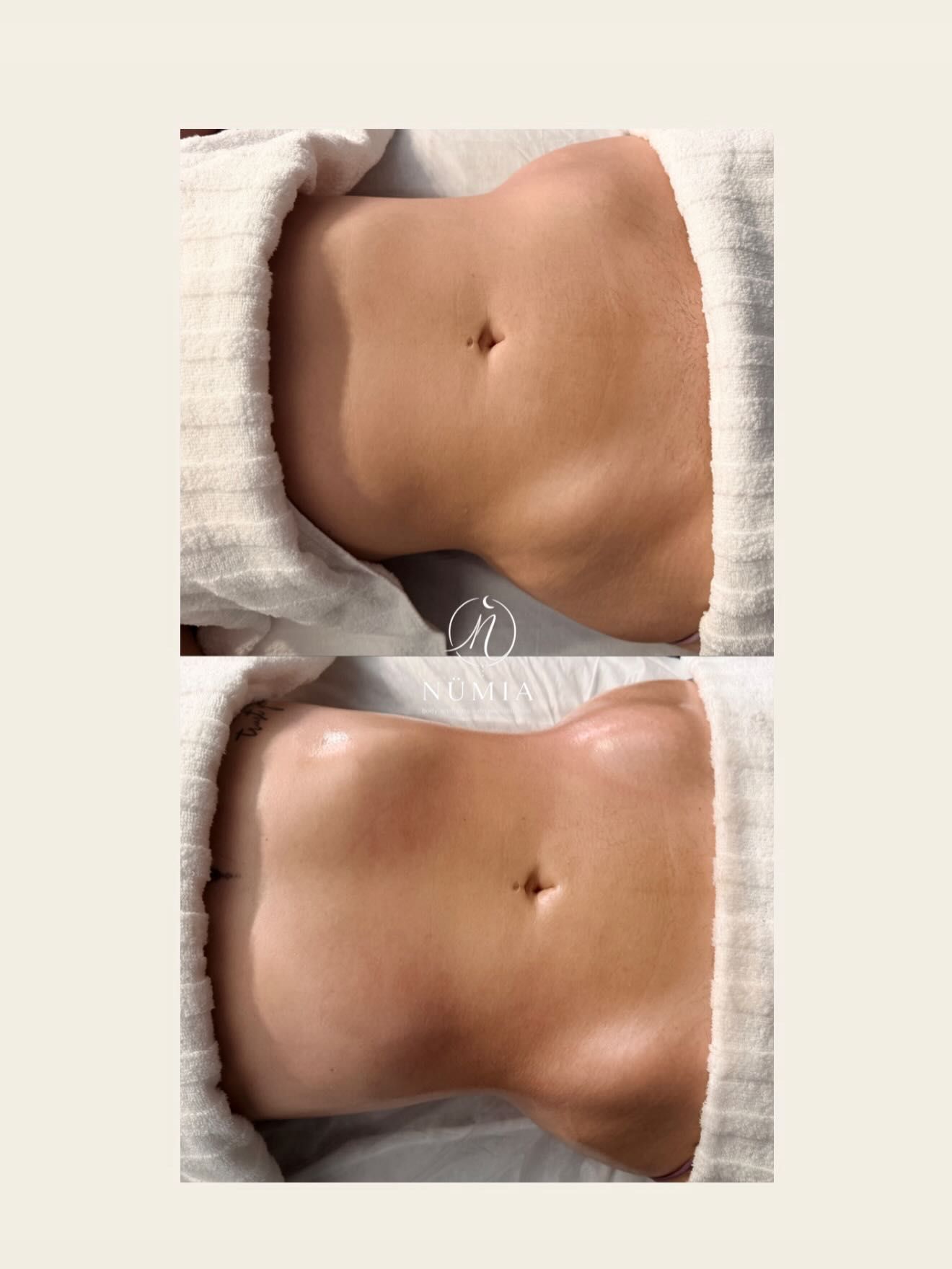 Dos primeros planos, uno al lado del otro, de un abdomen tonificado bajo una iluminación suave.