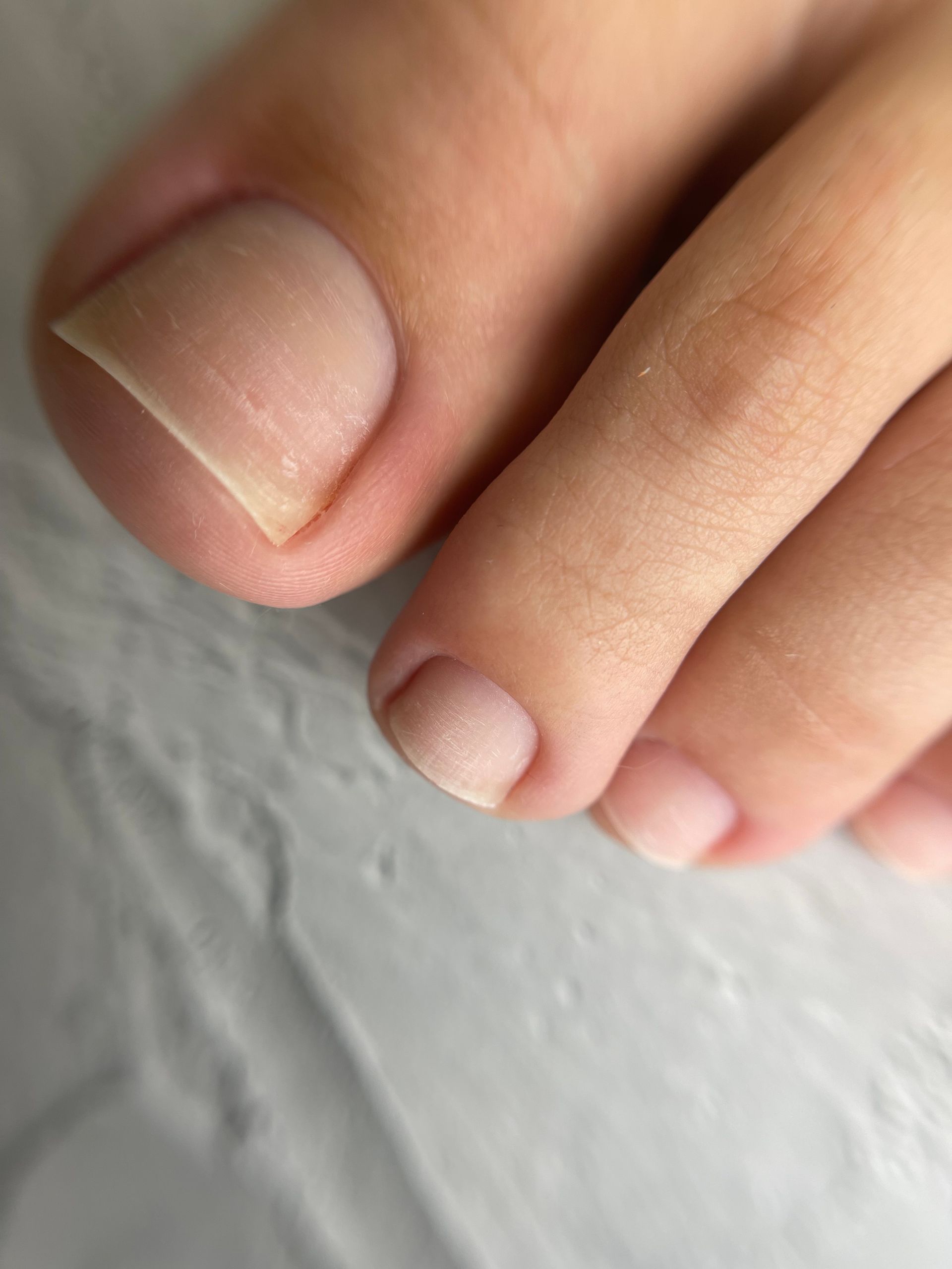 Preparación de uñas