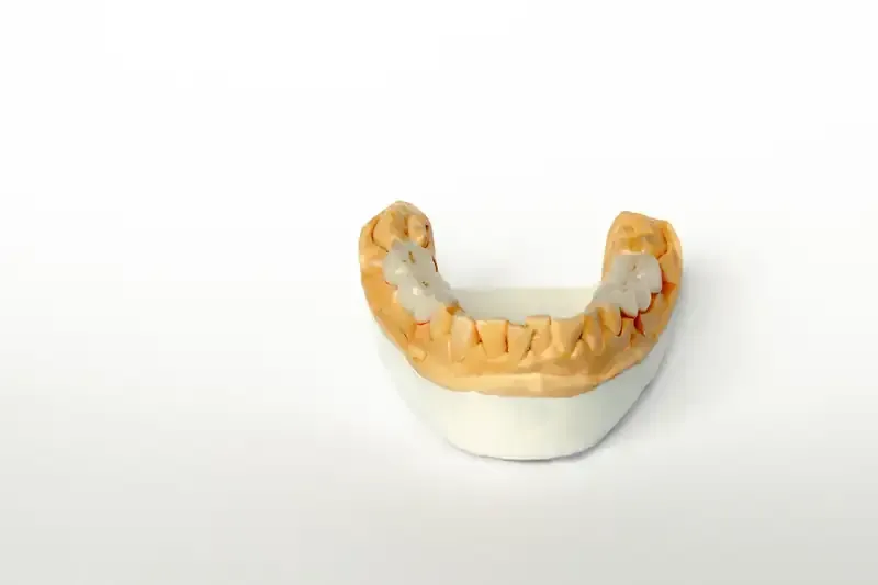 Molde dental con dientes, colocado sobre un bloque blanco, sobre un fondo blanco.