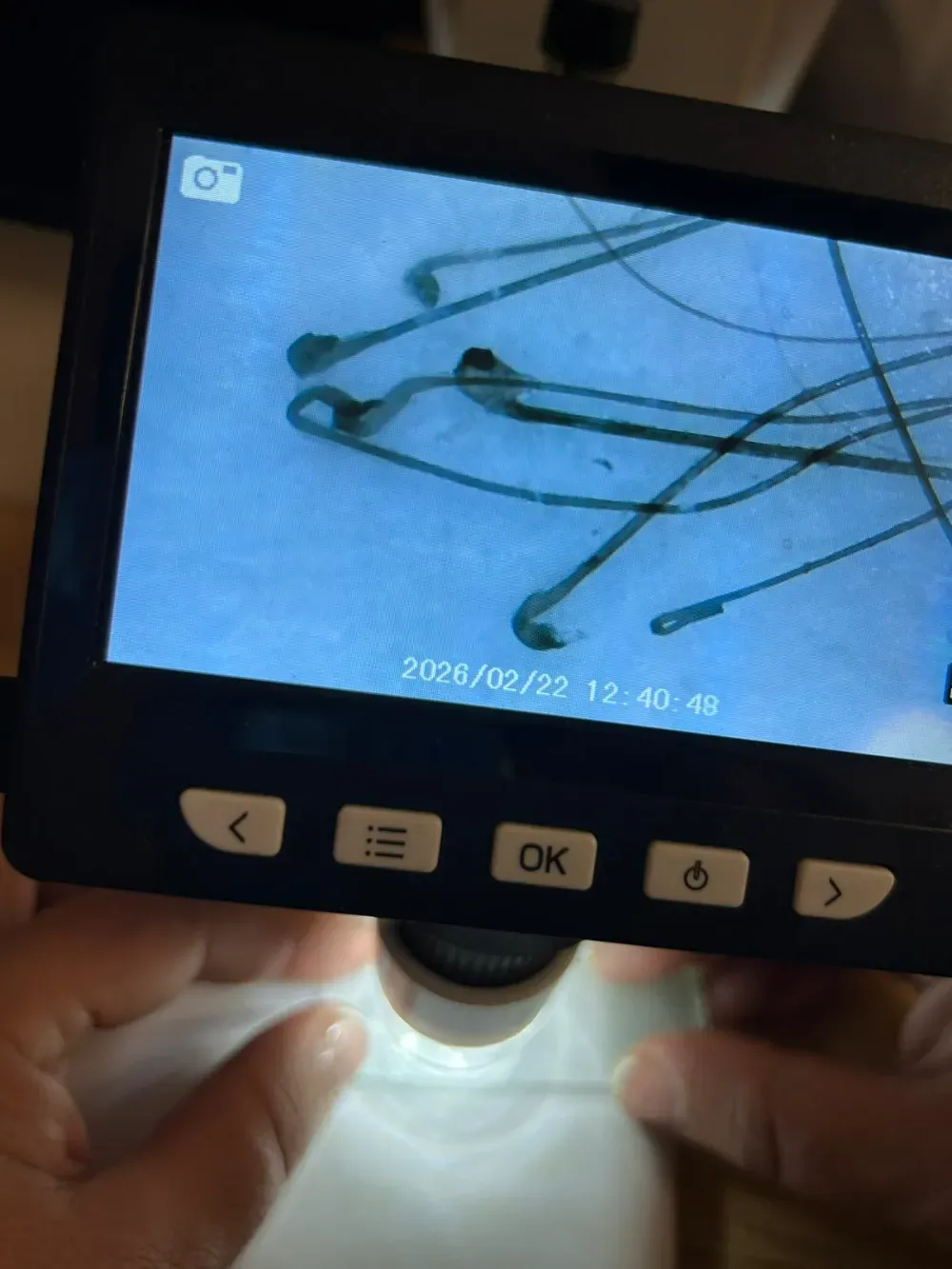 La pantalla de un microscopio digital portátil muestra una imagen ampliada de varios folículos pilosos.