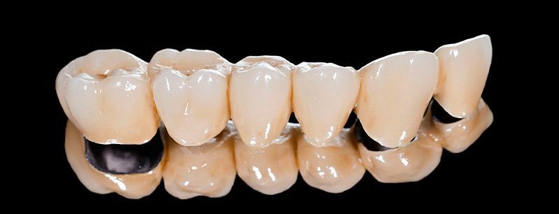 Un primer plano de un conjunto de dientes sobre un fondo negro.