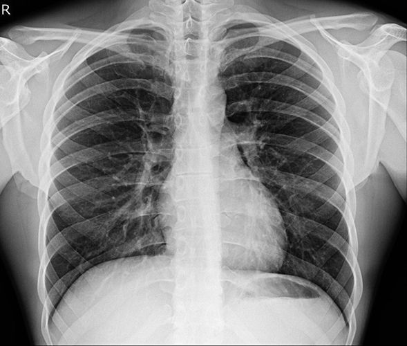 Ιατρός  ακτινολόγος  Φραγκάκης  Γεώργιος