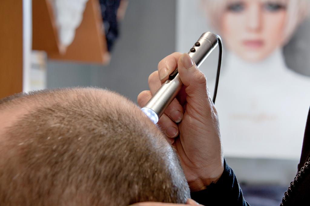 Diagnostic du cuir chevelu