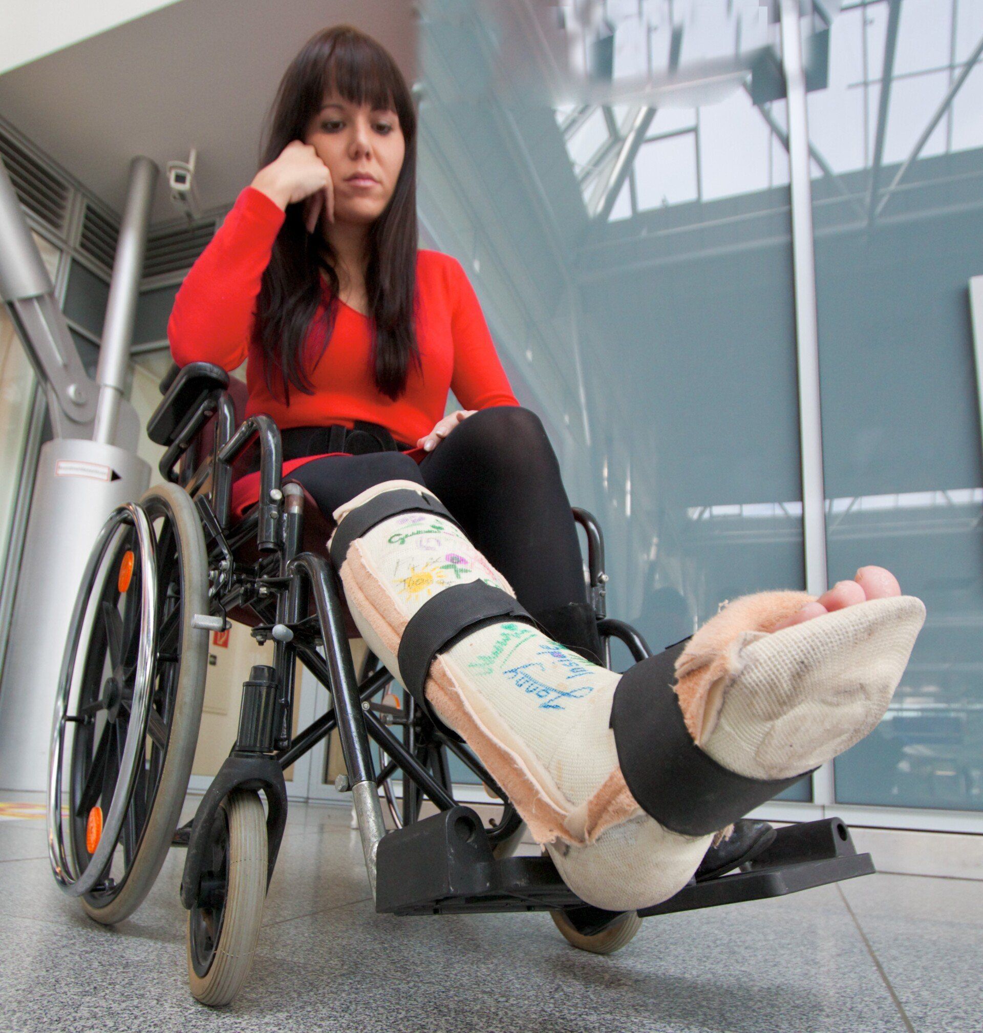 Une jeune femme en fauteuil roulant avec une jambe cassée