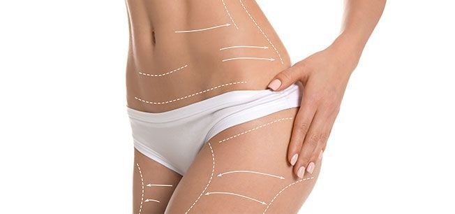 La mujer lleva ropa interior blanca y tiene líneas dibujadas en su cuerpo.
