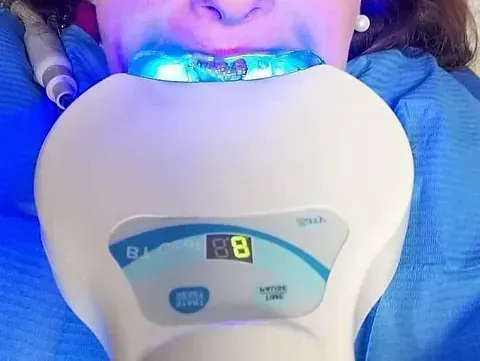 Una mujer se está blanqueando los dientes con una máquina que tiene el número 88.