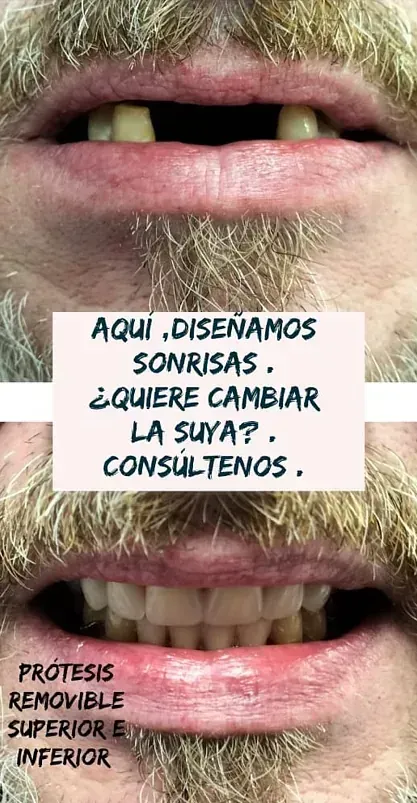 Un primer plano de la boca de un hombre con barba y dientes.