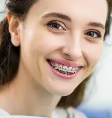Un primer plano de una mujer con aparatos dentales sonriendo.