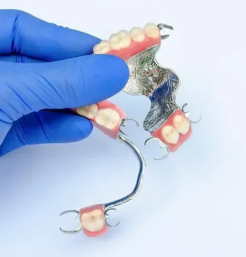 Una persona que lleva guantes azules sostiene una dentadura postiza en la mano.