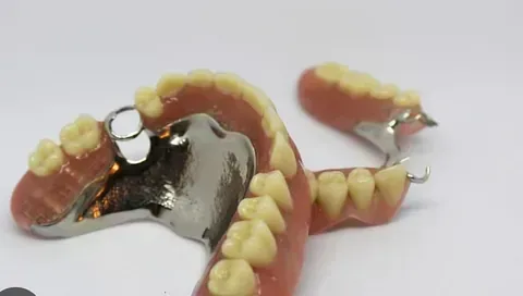 Un primer plano de una dentadura postiza sobre una superficie blanca.