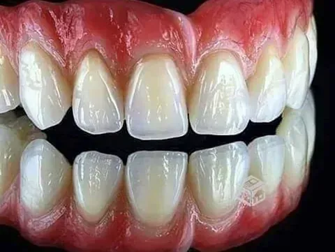 Un primer plano de los dientes de una persona sobre un fondo negro.