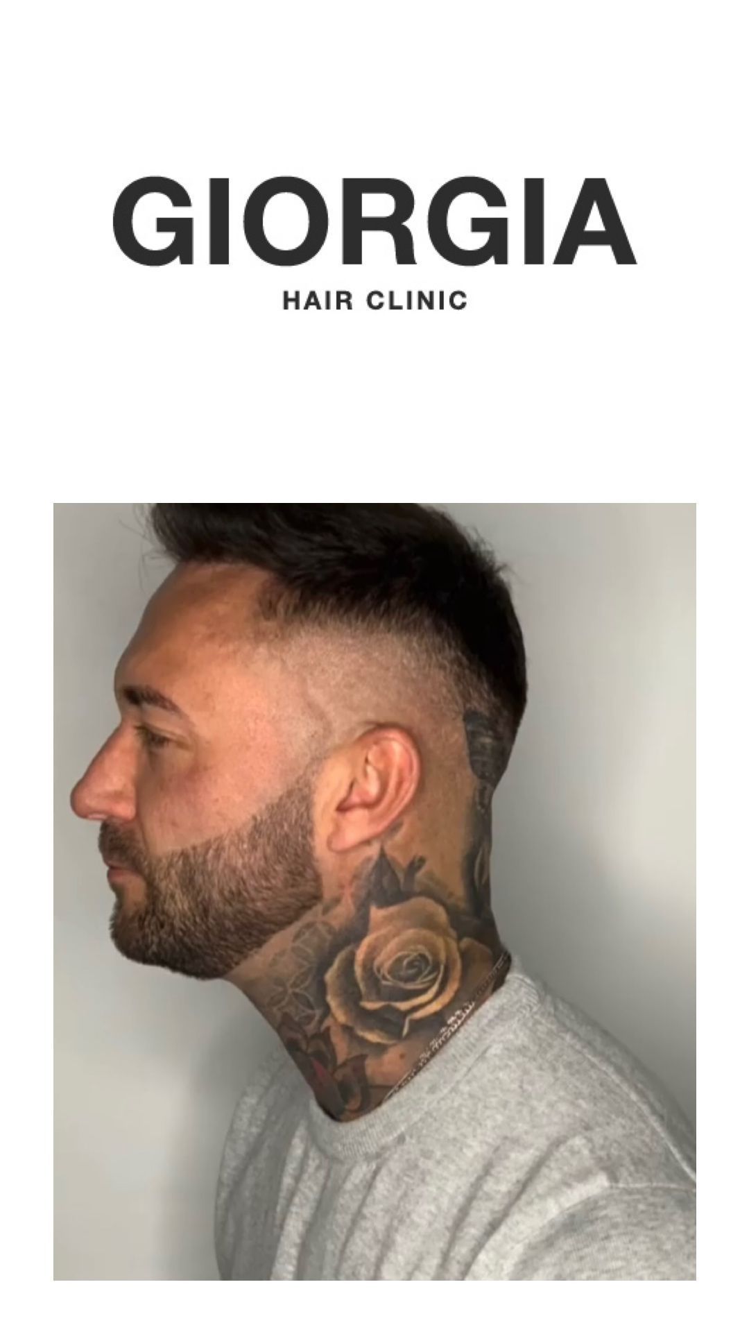 Hombre con corte de pelo y barba descoloridos, mostrando un tatuaje de rosa en el cuello, en una clínica.