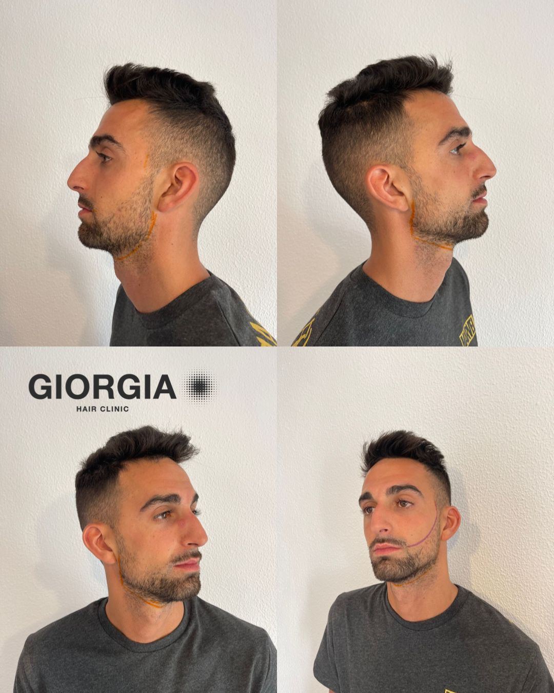 Cuatro planos de perfil de un hombre de pelo corto y oscuro, con camiseta gris, frente a una pared blanca. 