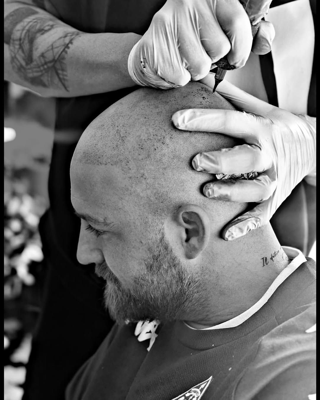 Hombre con corte de pelo y barba descoloridos, mostrando un tatuaje de rosa en el cuello, en una clínica.